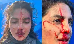ब्लफ सेट से खून भरी तस्वीरें देखने के बाद प्रियंका चोपड़ा के फैंस हुए परेशान, कहा- ‘ये क्या हो गया’