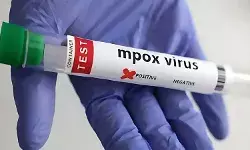 Mpox: WHO को क्यों बदलना पड़ा मंकीपॉक्स का नाम? जानें पूरी वजह