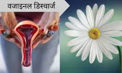 वो गीलापन असहज कर देता है...जानें वाइट डिस्चार्ज से जुड़ी जरूरी बातें