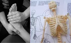 किन कारणों से कमजोर होने लगती हैं हड्डियां? जानें, बचाव के लिए क्या करें