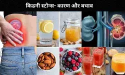 क्यों होते हैं किडनी स्टोन, ये हैं बचाव और इलाज से जुड़ी जरूरी बातें