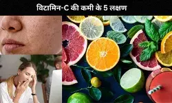 हर समय थकान लगना और त्वचा का बेजान दिखना, विटामिन-C की कमी के 5 लक्षण