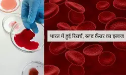 भारतीय में रिसर्च 73% सफलता, ब्लड कैंसर के इलाज में जीन थेरेपी से उम्मीद
