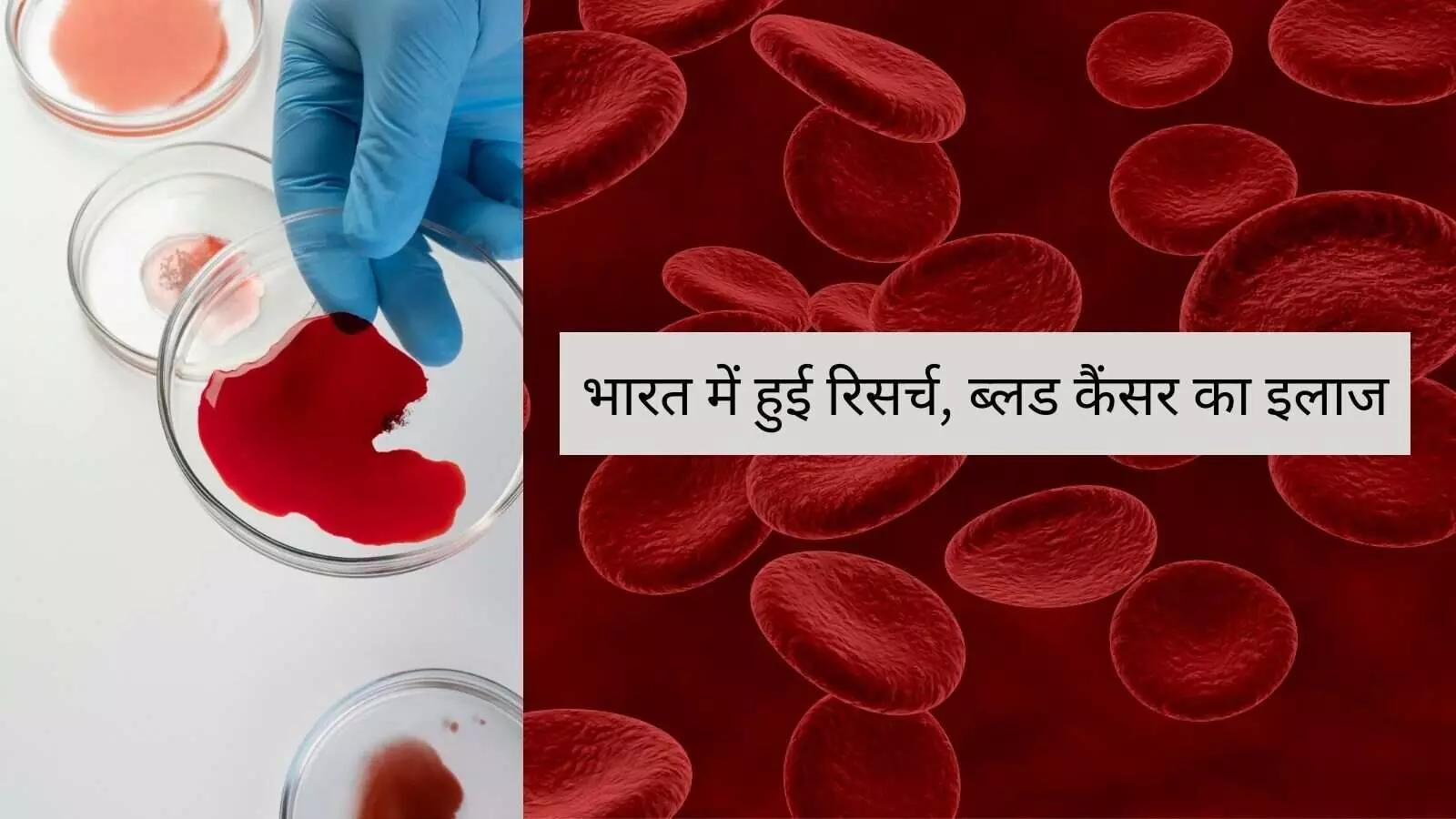 भारतीय में रिसर्च 73% सफलता, ब्लड कैंसर के इलाज में जीन थेरेपी से उम्मीद भारतीय में रिसर्च 73% सफलता, ब्लड कैंसर के इलाज में जीन थेरेपी से उम्मीद