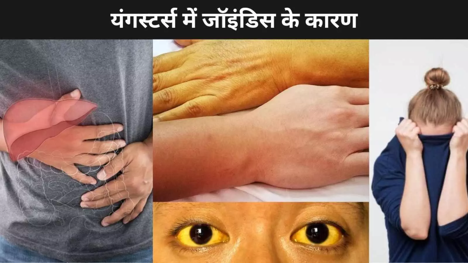 घर से दूर रहकर बच्चे क्यों हो जाते हैं जॉन्डिस का शिकार? कारण और समाधान