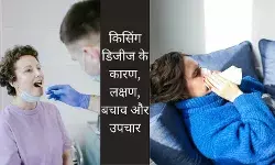 थकान-कमजोरी और गले में लिम्फ नोड्स, ये हो सकते हैं किसिंग डिजीज के लक्षण