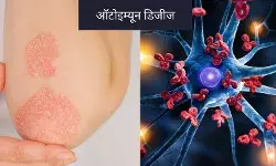 इम्युनिटी जरूरी है लेकिन ओवर ऐक्टिव इम्यून सिस्टम बन सकता है खतरा!