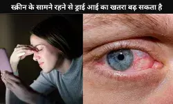 युवा में तेजी से बढ़ रही ड्राई आई बीमारी, जानिए कारण और बचाव के उपाय