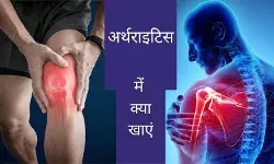 बढ़ती उम्र में सताने लगती है अर्थराइटिस, ये चीजें खाने से मिलेगा फायदा
