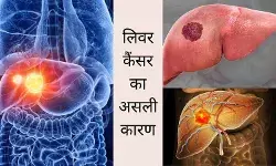 पहचानें इस साइलेंट किलर को, ये है लिवर कैंसर की असली वजह