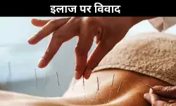 Kerala Acupuncture health
