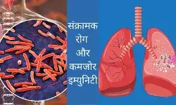 TB Disease causes prevention immunity boosting