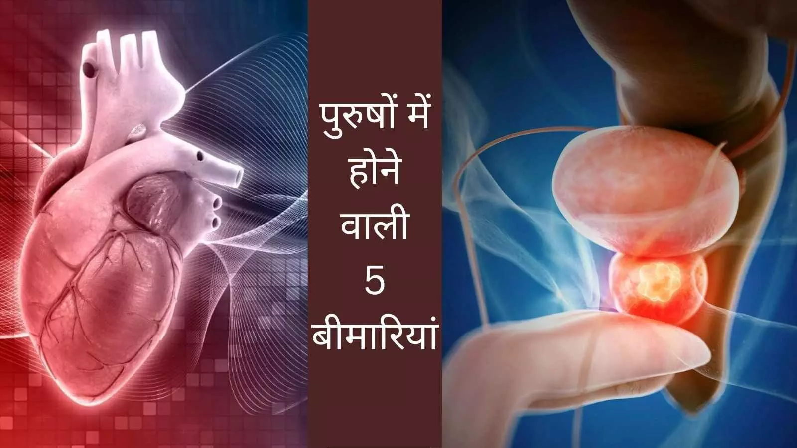 more common sever disease in men more common sever disease in men