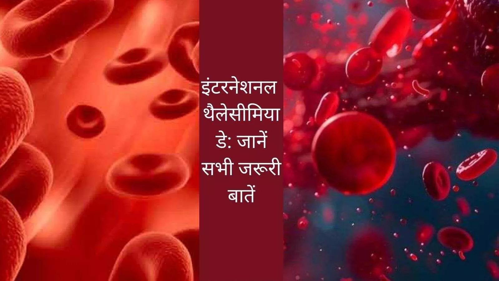 Thalassemia treatment cause blood disease Thalassemia treatment cause blood disease