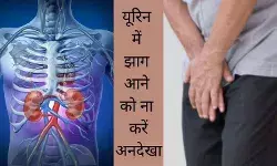 Foamy urine Urine with bubbles Proteinuria, Urine infection Kidney damage symptoms