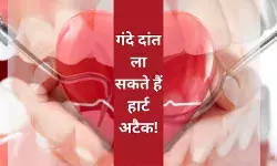 Dental care oral health heart attack cause of heart attack