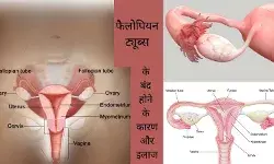 Fallopian tubes Blocked fallopian tubes Fallopian tube blockage Fertility issues