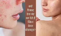 Beauty Products Skin Care Products Acne Causes