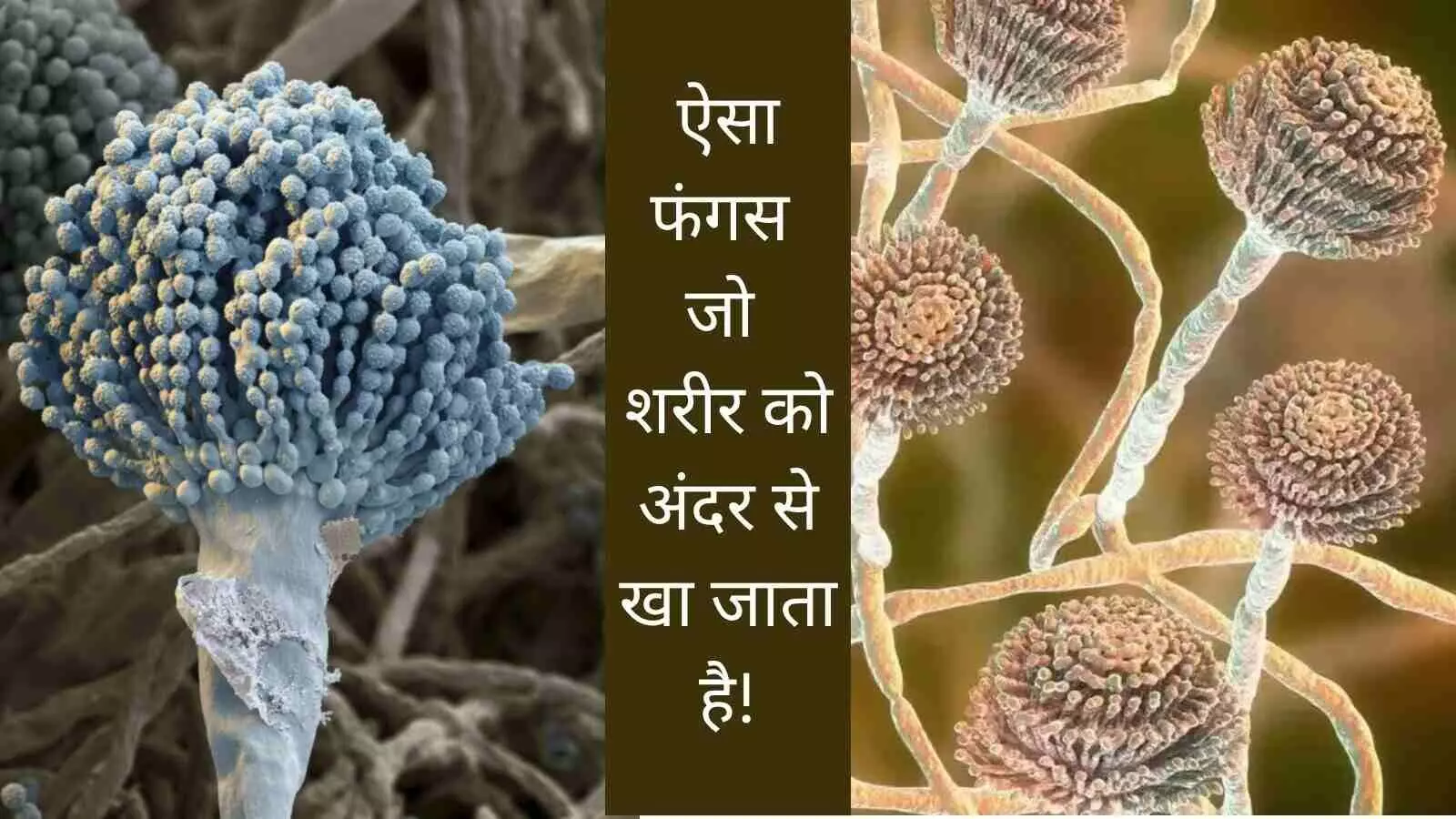 Deadly Fungus Aspergillus Eat body inside out Deadly Fungus Aspergillus Eat body inside out