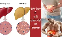 Fatty liver Liver fibrosis Cirrhosis Liver transplant Gastroenterologist