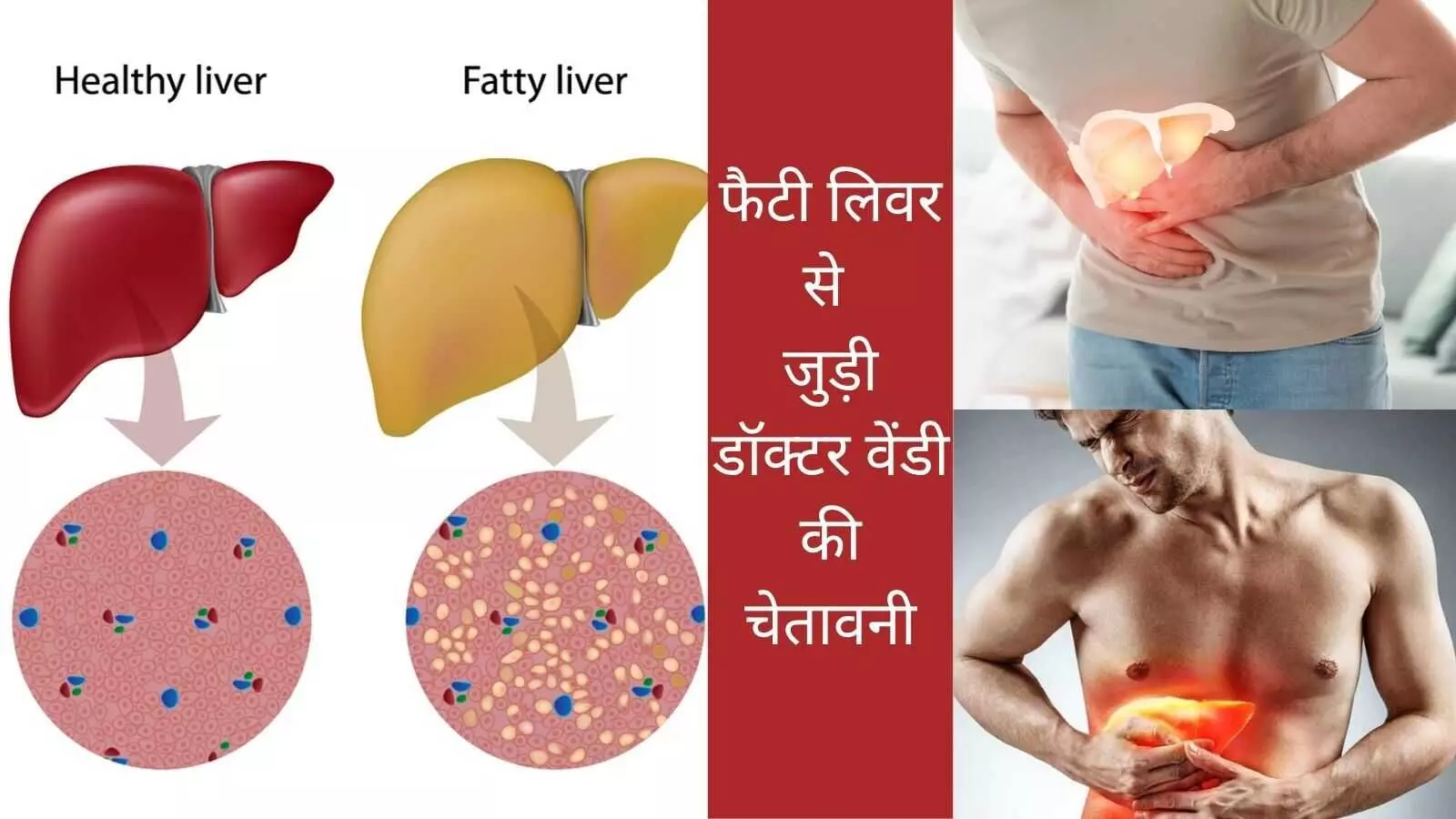 Fatty liver Liver fibrosis Cirrhosis Liver transplant Gastroenterologist Fatty liver Liver fibrosis Cirrhosis Liver transplant Gastroenterologist