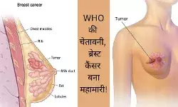 Breast cancer Cancer in women WHO breast cancer report Early cancer detection