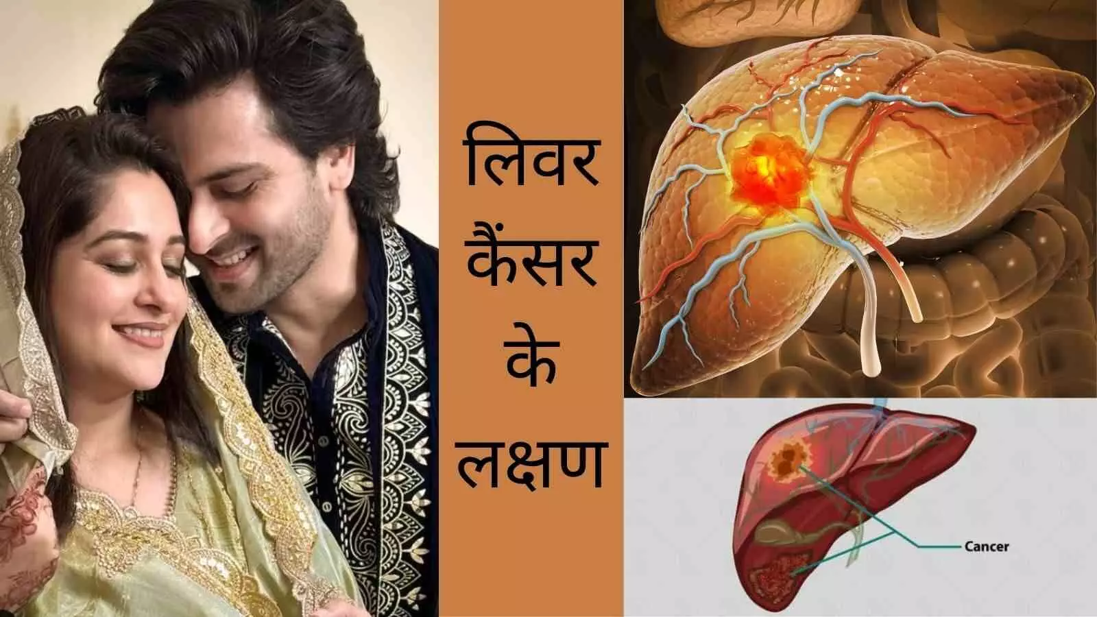 Fatty liver disease Dipika Kakar Liver cancer stage 2 Liver cancer symptoms Liver cancer causes Fatty liver disease Dipika Kakar Liver cancer stage 2 Liver cancer symptoms Liver cancer causes