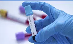 covid 19 cases in delhi
