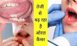 Oral cancer in India Tobacco use statistics Smokeless tobacco effects Gutka and cancer link India cancer survival rate