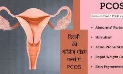 PCOS and obesity Urban lifestyle and PCOS