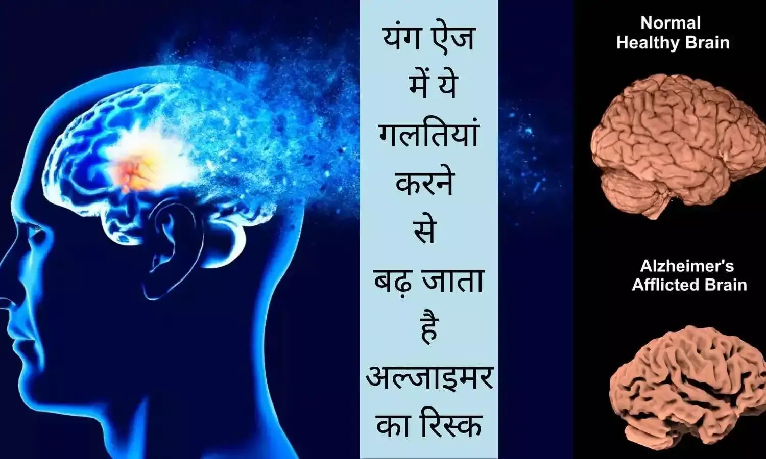 brain shrinkage active lifestyle dementia prevention Alzheimer disease