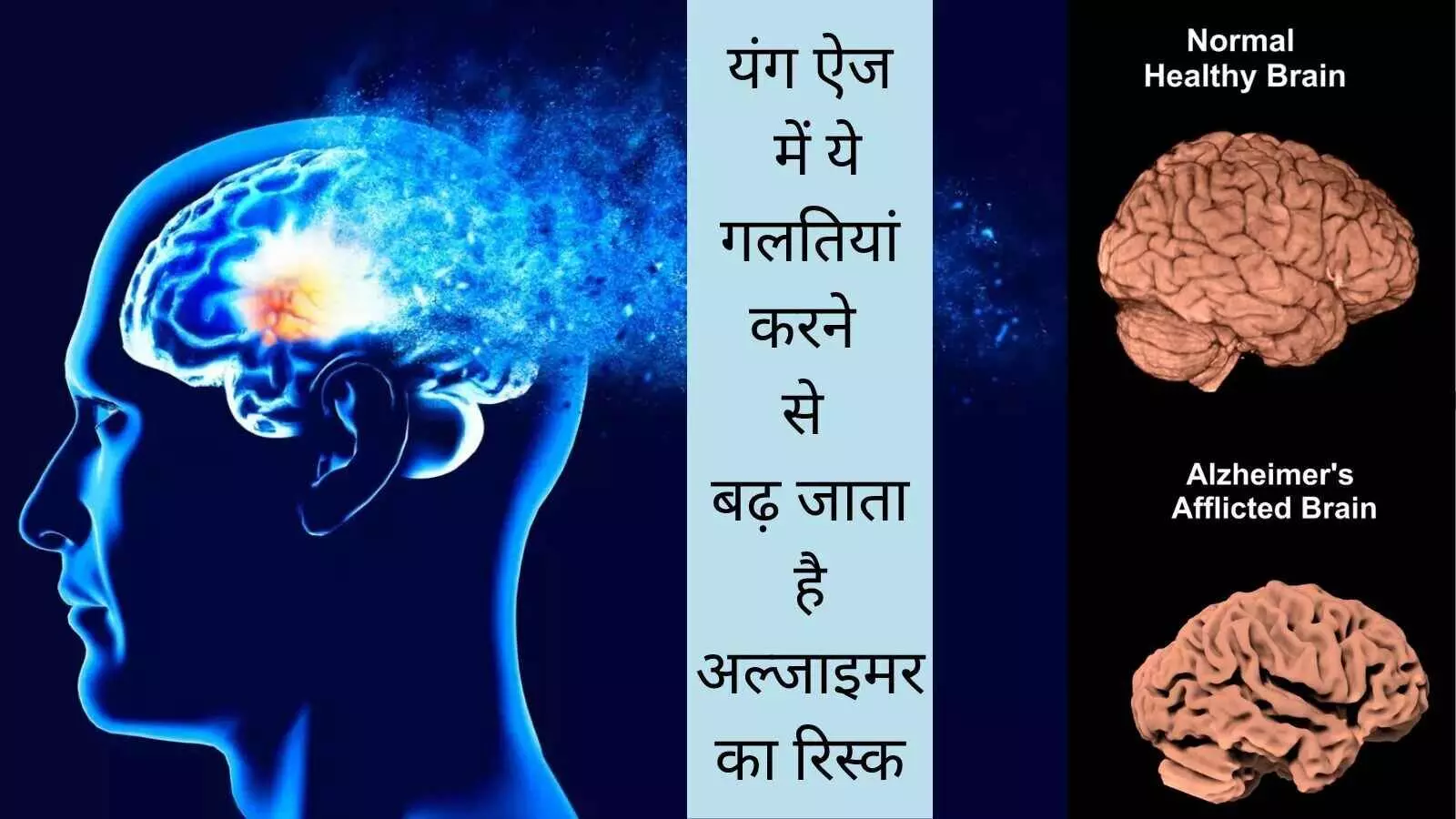 brain shrinkage active lifestyle dementia prevention Alzheimer disease