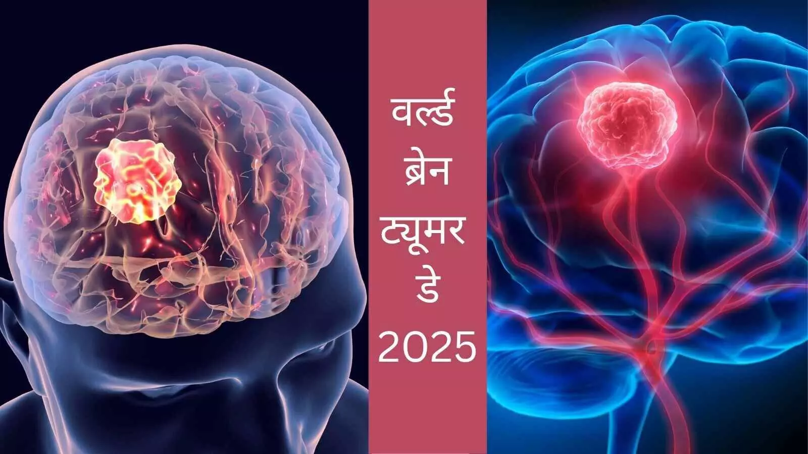 brain tumor healthy brain routine mental health tips how to boost brain health brain tumor healthy brain routine mental health tips how to boost brain health