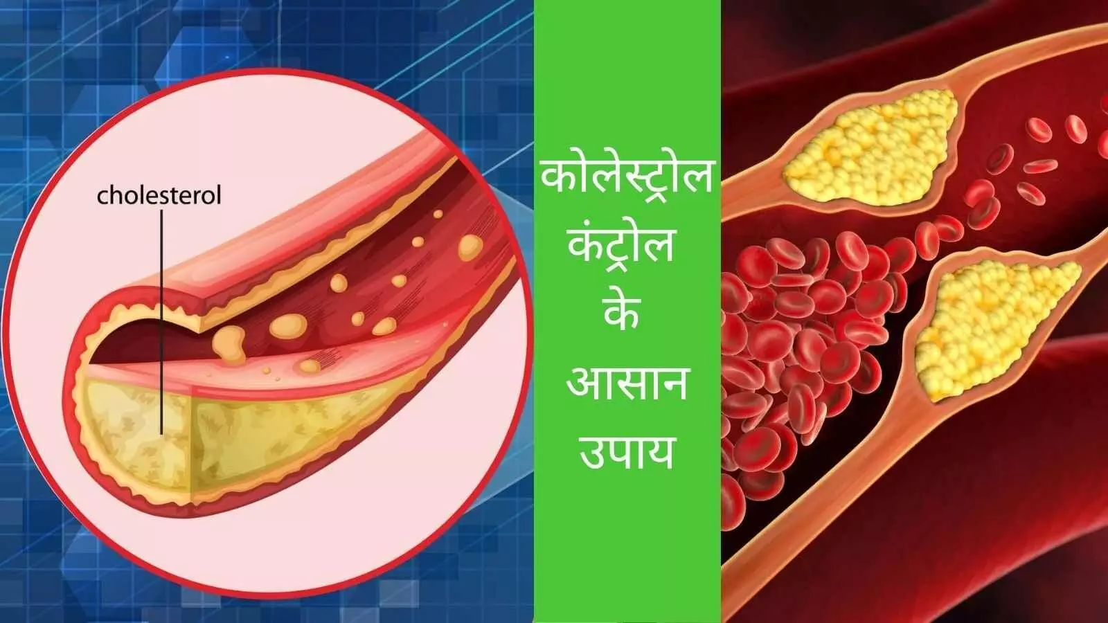 Cholesterol After 50 Plus Age Natural ways to control cholesterol Cholesterol after 50, Healthy heart diet Diet for cholesterol control How to reduce LDL naturally Heart friendly foods Cholesterol After 50 Plus Age Natural ways to control cholesterol Cholesterol after 50, Healthy heart diet Diet for cholesterol control How to reduce LDL naturally Heart friendly foods