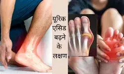 Uric acid symptoms What is uric acid Normal range of uric acid Uric acid blood report