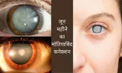 Artificial Eye Lens, UV Protection Glasses, Diabetes and Cataract Age-related Cataract Eye Care After 40 Eye Health Tips Vision Loss Prevention Early Cataract Detection Cataract Complications