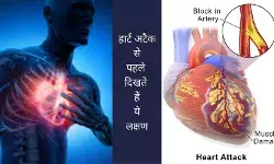 Fatigue Cold sweat Silent heart attack Heart disease signs Heart attack prevention