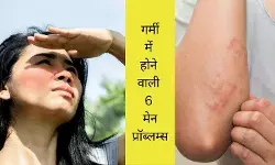 summer skin allergy acne and oily skin dry skin in summer summer skin care tips