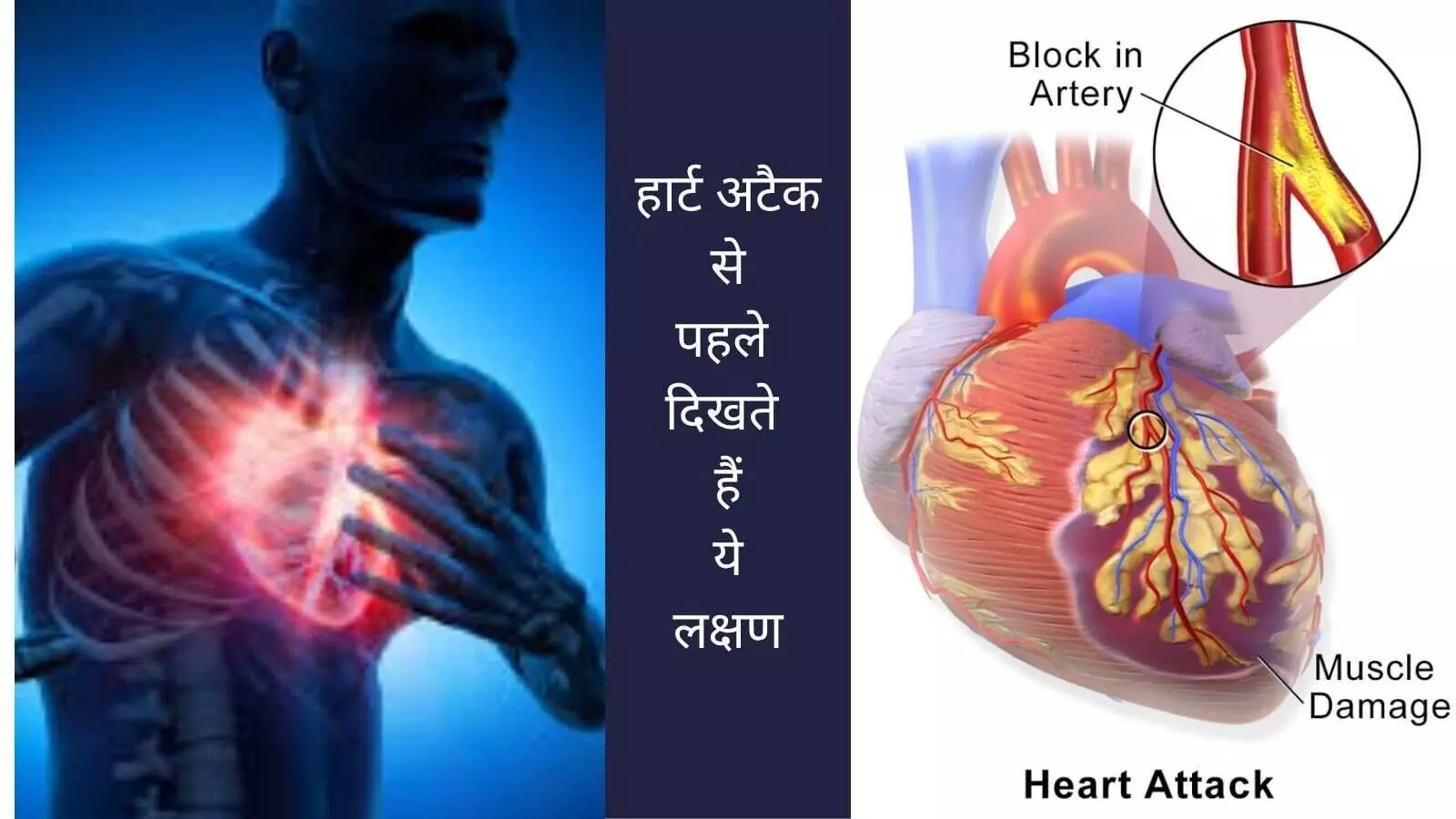 Fatigue Cold sweat Silent heart attack Heart disease signs Heart attack prevention Fatigue Cold sweat Silent heart attack Heart disease signs Heart attack prevention