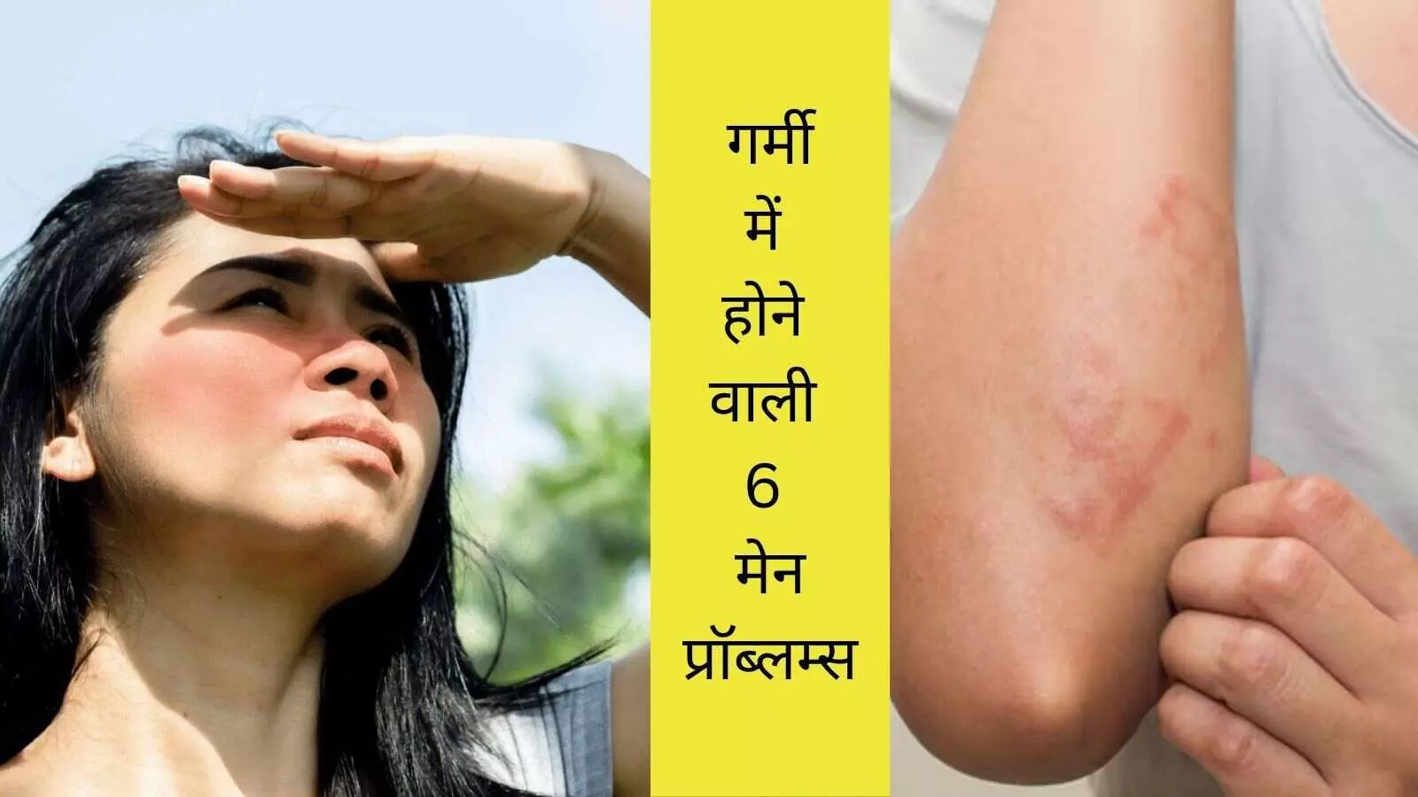summer skin allergy acne and oily skin dry skin in summer summer skin care tips summer skin allergy acne and oily skin dry skin in summer summer skin care tips