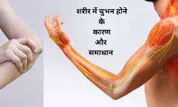 Paresthesia Tingling in hands Tingling in feet Numbness Ant crawling sensation