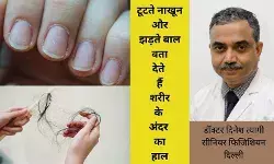 Hair Care, Nail Care, Hair Care Tips, Nail Care Tips, Hair Fall, Hair Thinning, Premature Greying, Fungal Infection, Split Ends