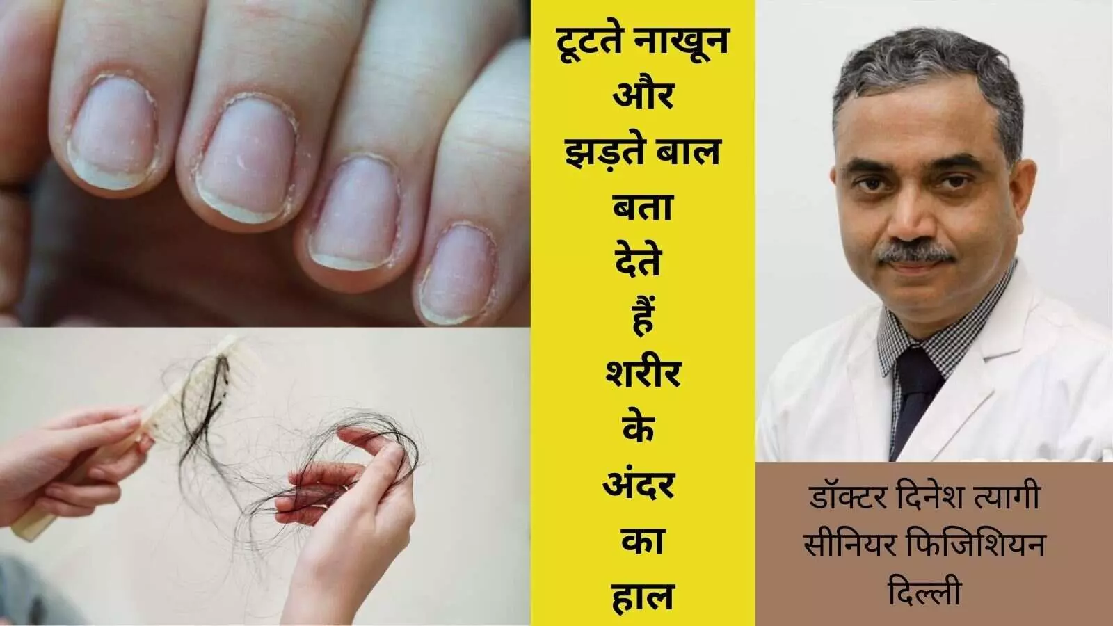 Hair Care, Nail Care, Hair Care Tips, Nail Care Tips, Hair Fall, Hair Thinning, Premature Greying, Fungal Infection, Split Ends Hair Care, Nail Care, Hair Care Tips, Nail Care Tips, Hair Fall, Hair Thinning, Premature Greying, Fungal Infection, Split Ends