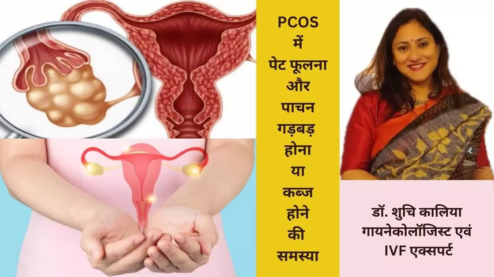 PCOS Polycystic Ovary Syndrome Ovarian Disorder Constipation Bloating Digestive Issues Hormonal Imbalance PCOS Polycystic Ovary Syndrome Ovarian Disorder Constipation Bloating Digestive Issues Hormonal Imbalance
