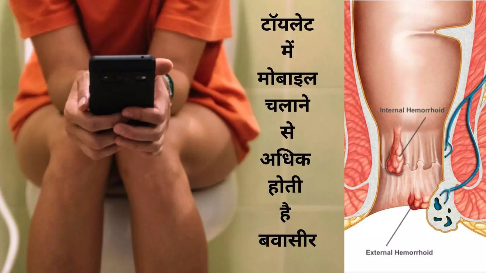 Hemorrhoids Research Causes of piles Phone in toilet Smartphone health risks Hemorrhoids Cause Indian study hemorrhoids