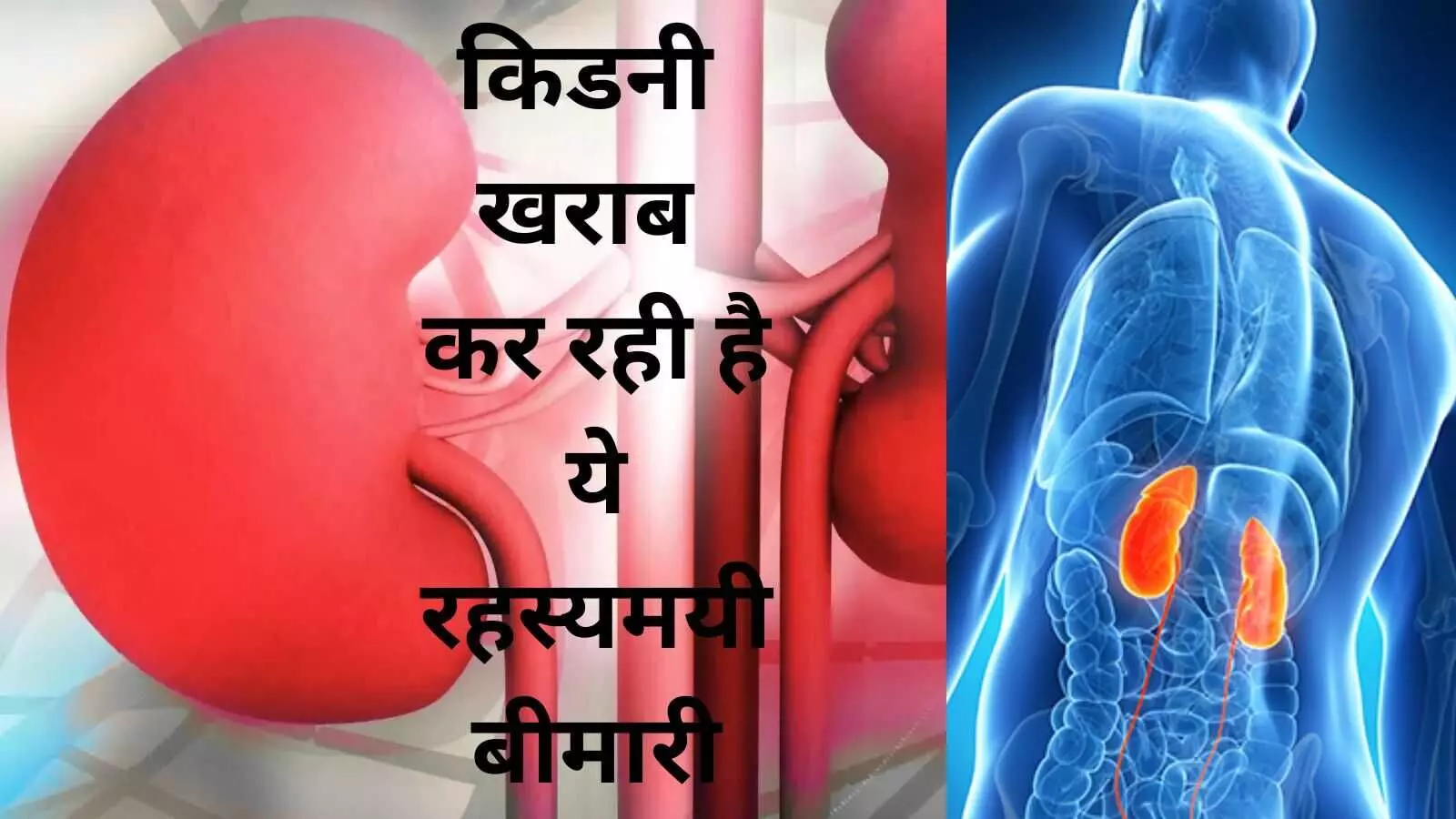 Mysterious Chronic Kidney Disease CKDu Kidney function loss