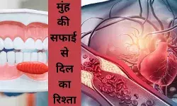 Heart attack Cholesterol Oral hygiene Bacteria