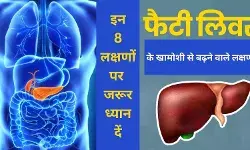 Fatty liver disease Non-alcoholic fatty liver Liver disease symptoms