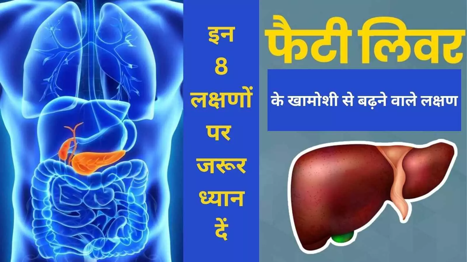 Fatty liver disease Non-alcoholic fatty liver Liver disease symptoms