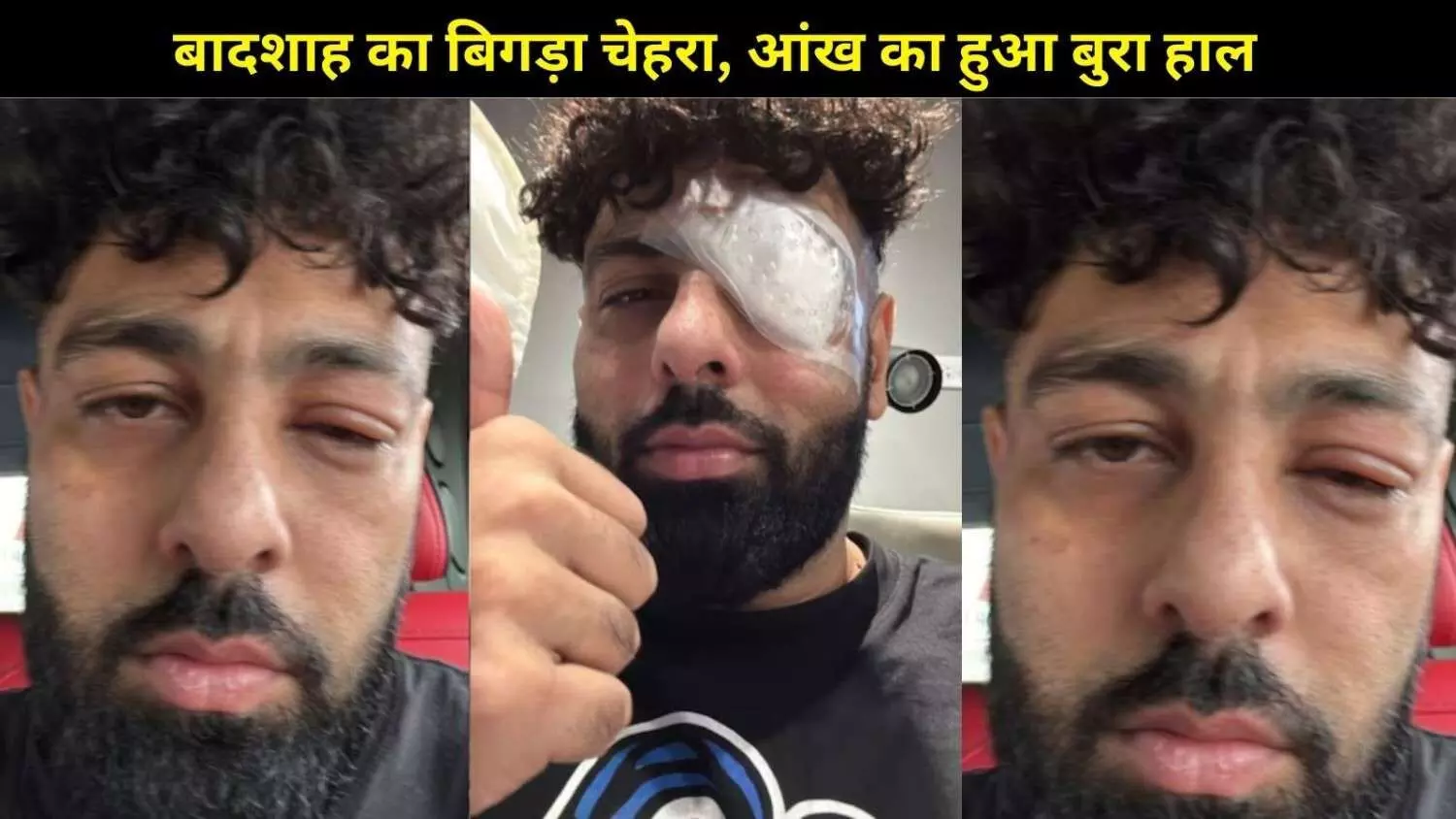 बादशाह की आंख पर पट्टी: सोशल मीडिया पर वायरल तस्वीरें, फैंस बोले- भाई क्या हो गया?